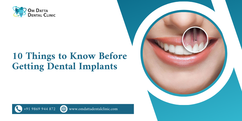 10 Things to Know Before Getting Dental Implants