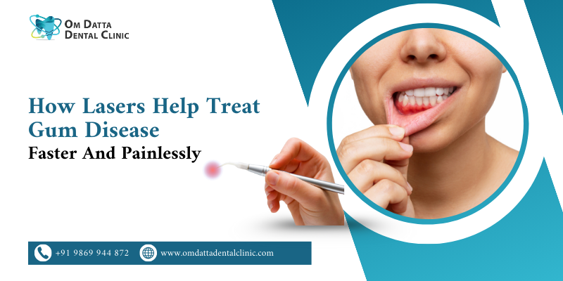 How Lasers Help Treat Gum Disease Faster and Painlessly