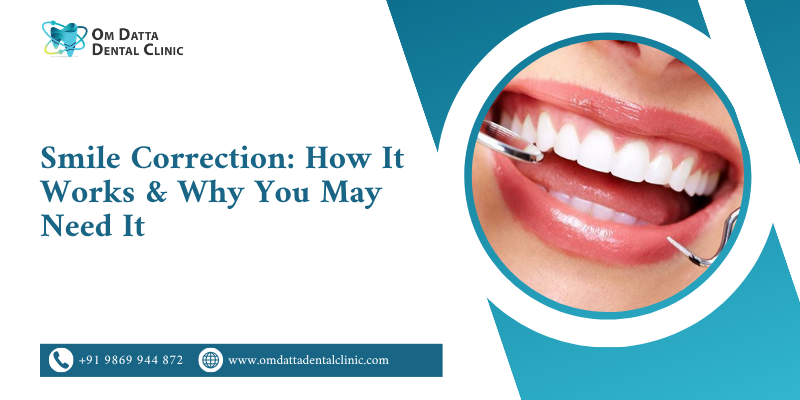 Smile Correction: How It Works & Why You May Need It